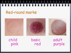 Red-round marks